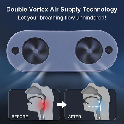 Skanto | Micro CPAP Anti-Snoring Device | Mask-Free Sleep Apnea Treatment