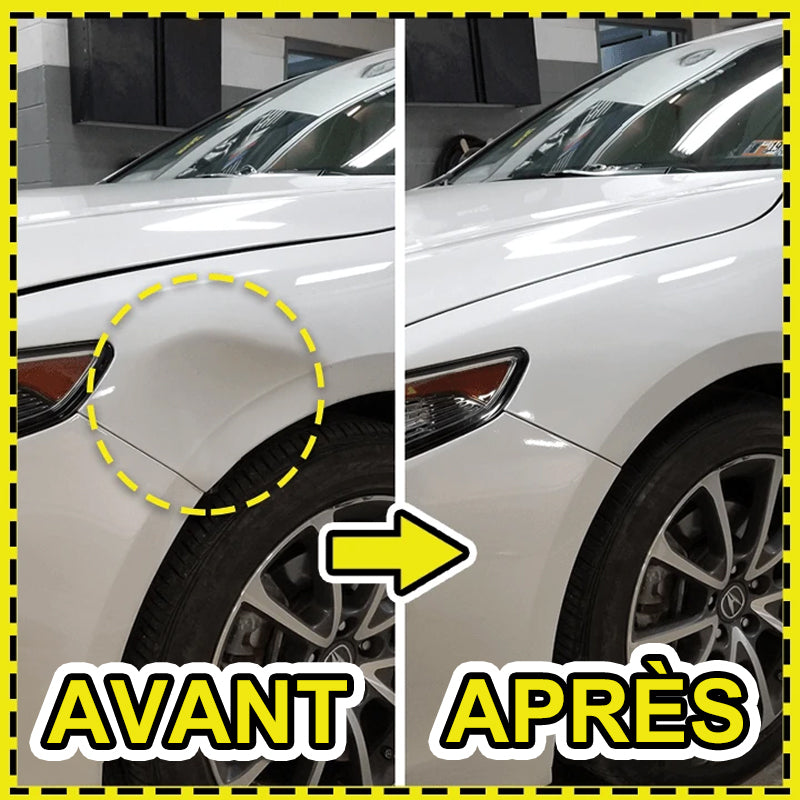 Mini car dent repair extractor | Kalsten