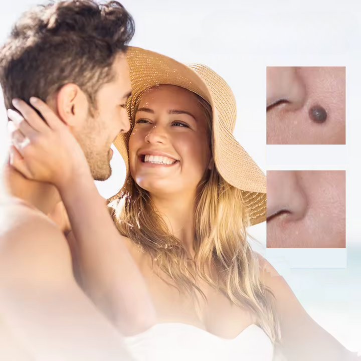 Kalsten | WartAway – Natural Wart Remover