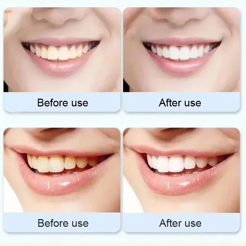 Kalsten | Super Probiotic-6 Toothpaste