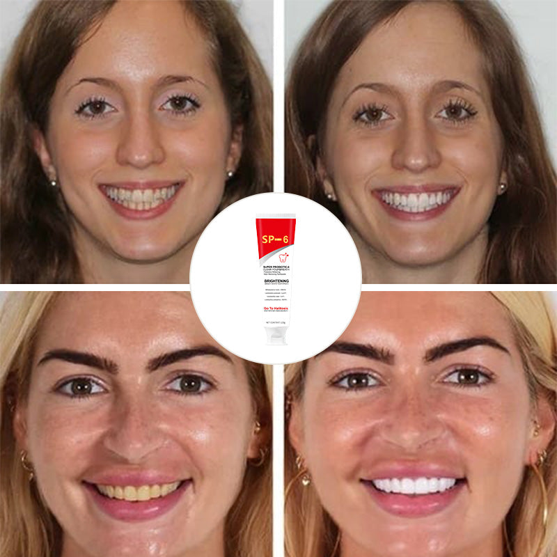 Kalsten | Super Probiotic-6 Toothpaste
