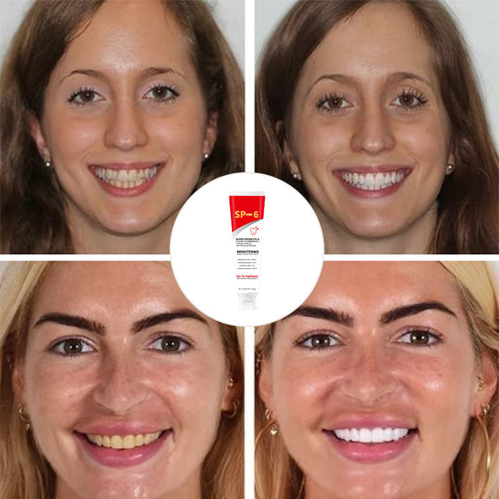 Kalsten | Super Probiotic-6 Toothpaste