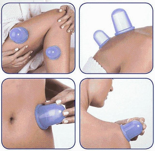 Anti Cellulite Vacuum Silicone Cups | Kalsten
