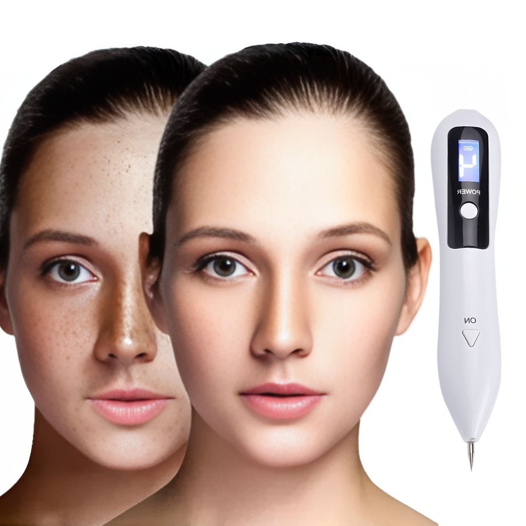 ClearSkinPro Laser Plasma Pen - Non-Invasive | for removal of freckles, skin tags, spots, moles, and tattoos at home Skanto