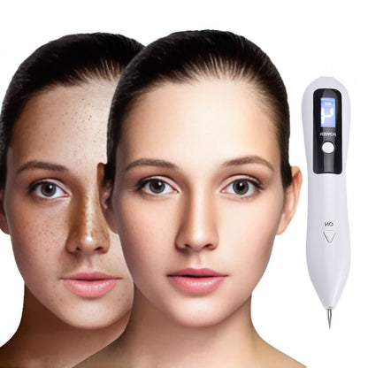 ClearSkinPro Laser Plasma Pen - Non-Invasive | for removal of freckles, skin tags, spots, moles, and tattoos at home Skanto