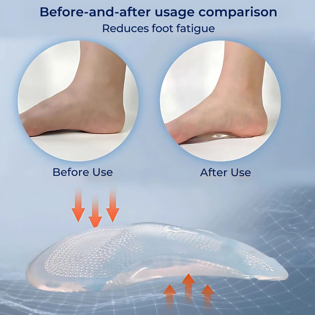ComfortStep Gel Arch Support Insoles | Relieve Foot Pain - Reduce Fatigue - Improve Posture - Shock Absorbing Insoles Kalsten