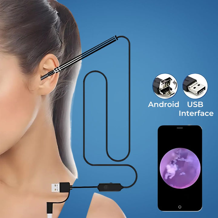 EarVision Professional Ear Endoscope – HD Inspection – Live Monitoring – Capture Images & Video – Removes Wax & Foreign Objects Kalsten
