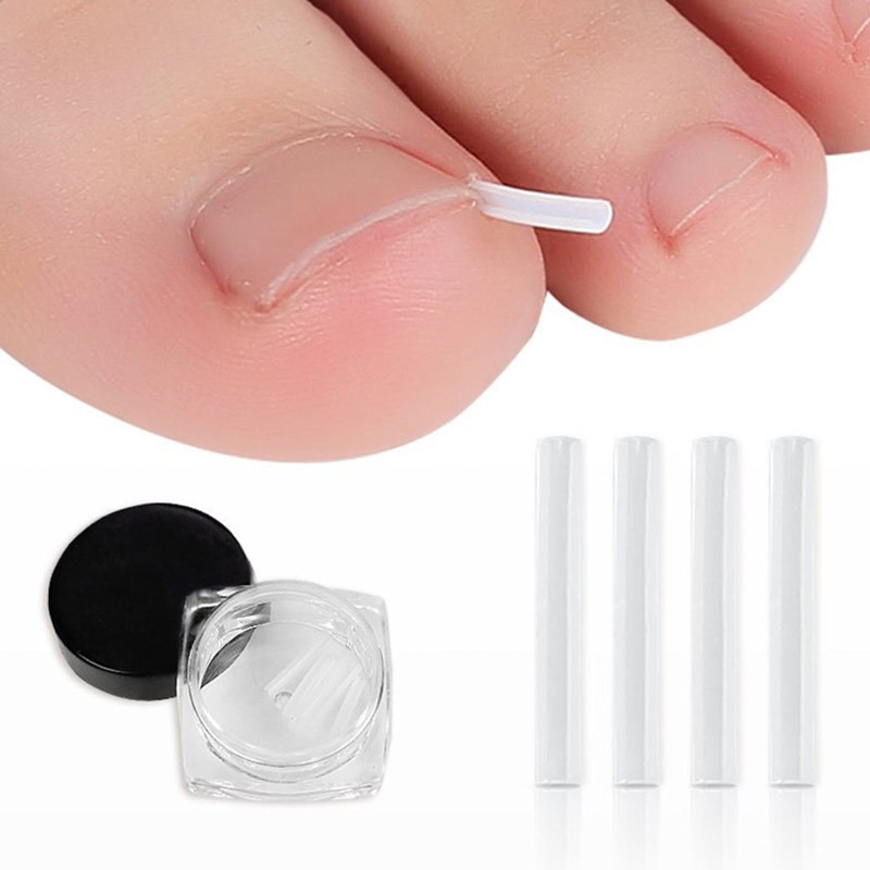 Kalsten | Toe Nail Support Pad