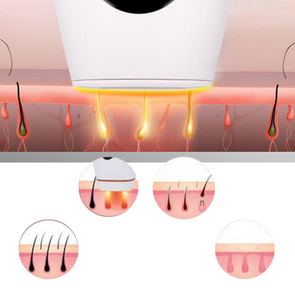 IPL Laser Hair Removal Device
