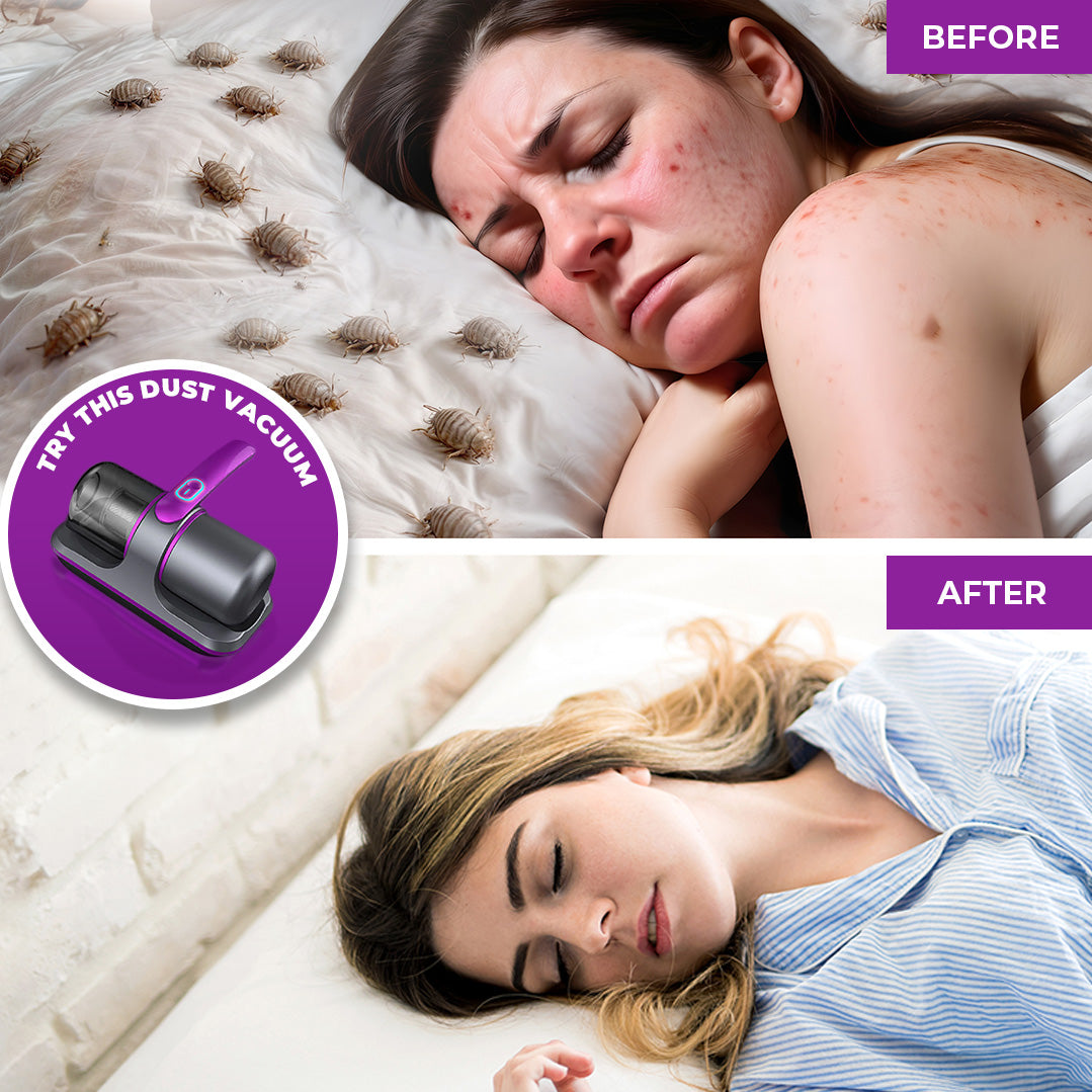 Skanto | Dustbane™ | Powerful Vacuum & Iron Duo for Furniture, Bedding & Home Cleaning