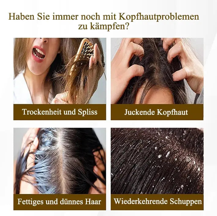 Kalsten | Scalp Massage Comb – Gentle Dandruff Removal & Care