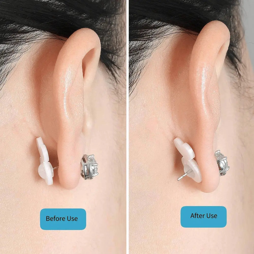 Kalsten | Earring Stabilizer – For secure hold of heavy earrings without sagging