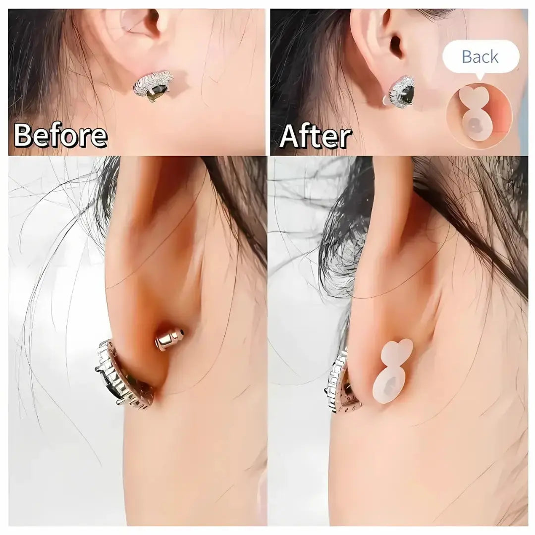 Kalsten | Earring Stabilizer – For secure hold of heavy earrings without sagging
