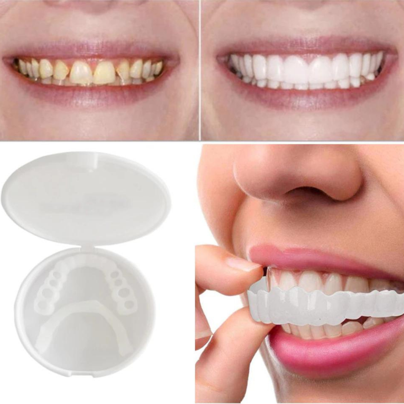 Kalsten | PerfectSnap | Always the perfect smile