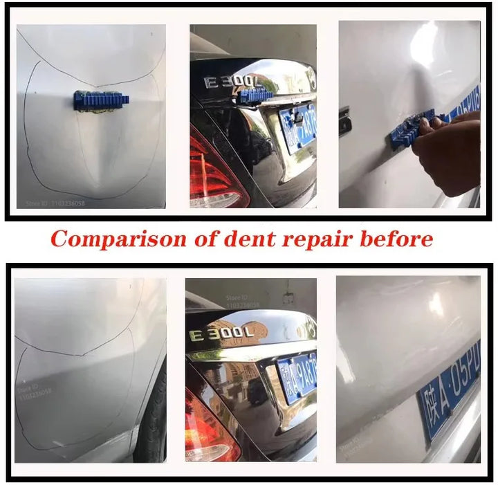 Dent Repair Tool Set Car Dents | Kalsten