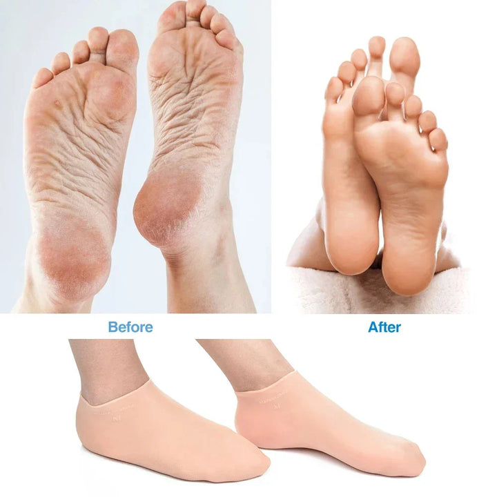 Kalsten | Silicone Wetsuit Beach Socks