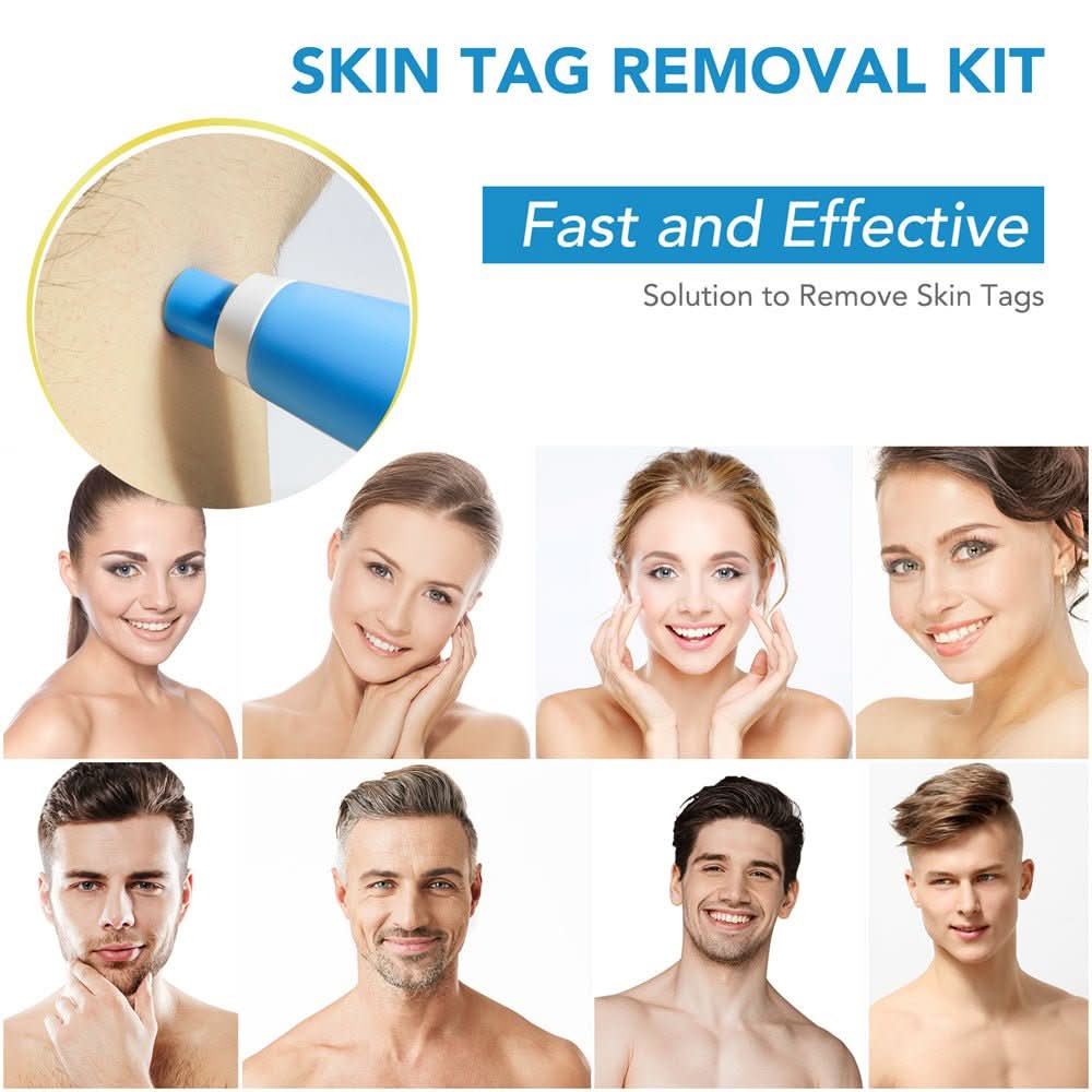 Kalsten | Skin spot remover for warts & skin tags