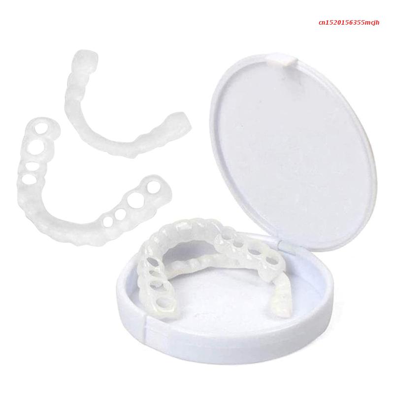 Kalsten | Snap-on Teeth™ - With these veneers, always have the perfect smile