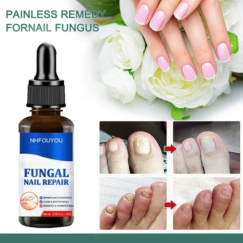 Kalsten | Nail Fungus Defender Serum