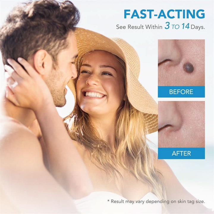 Kalsten | Skin spot remover for warts & skin tags