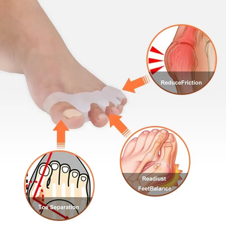 Kalsten | Soft Silicone Toe Separators for Bunion Relief and Alignment, 1 Pair