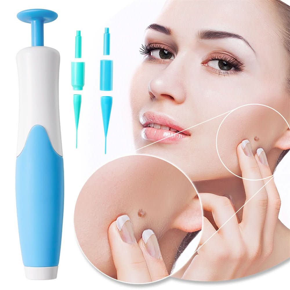 Kalsten | Skin spot remover for warts & skin tags