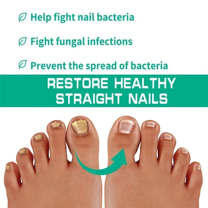 Kalsten | Nail Fungus Defender Serum