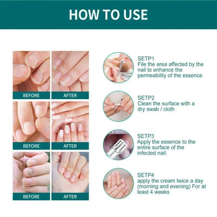 Kalsten | Nail Fungus Defender Serum