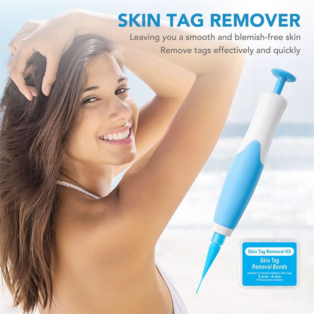 Kalsten | Skin spot remover for warts & skin tags