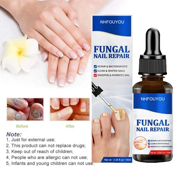 Kalsten | Nail Fungus Defender Serum