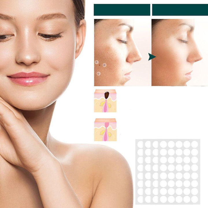 Kalsten | SkinClear - Plaster for the removal of spots and warts
