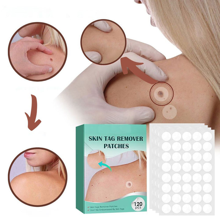 Kalsten | SkinClear - Plaster for the removal of spots and warts
