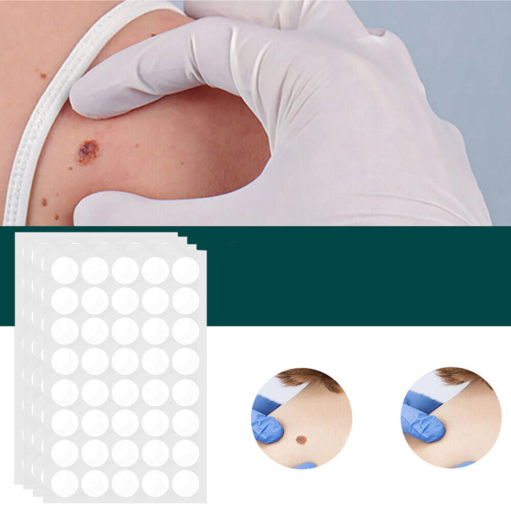 Kalsten | SkinClear - Plaster for the removal of spots and warts