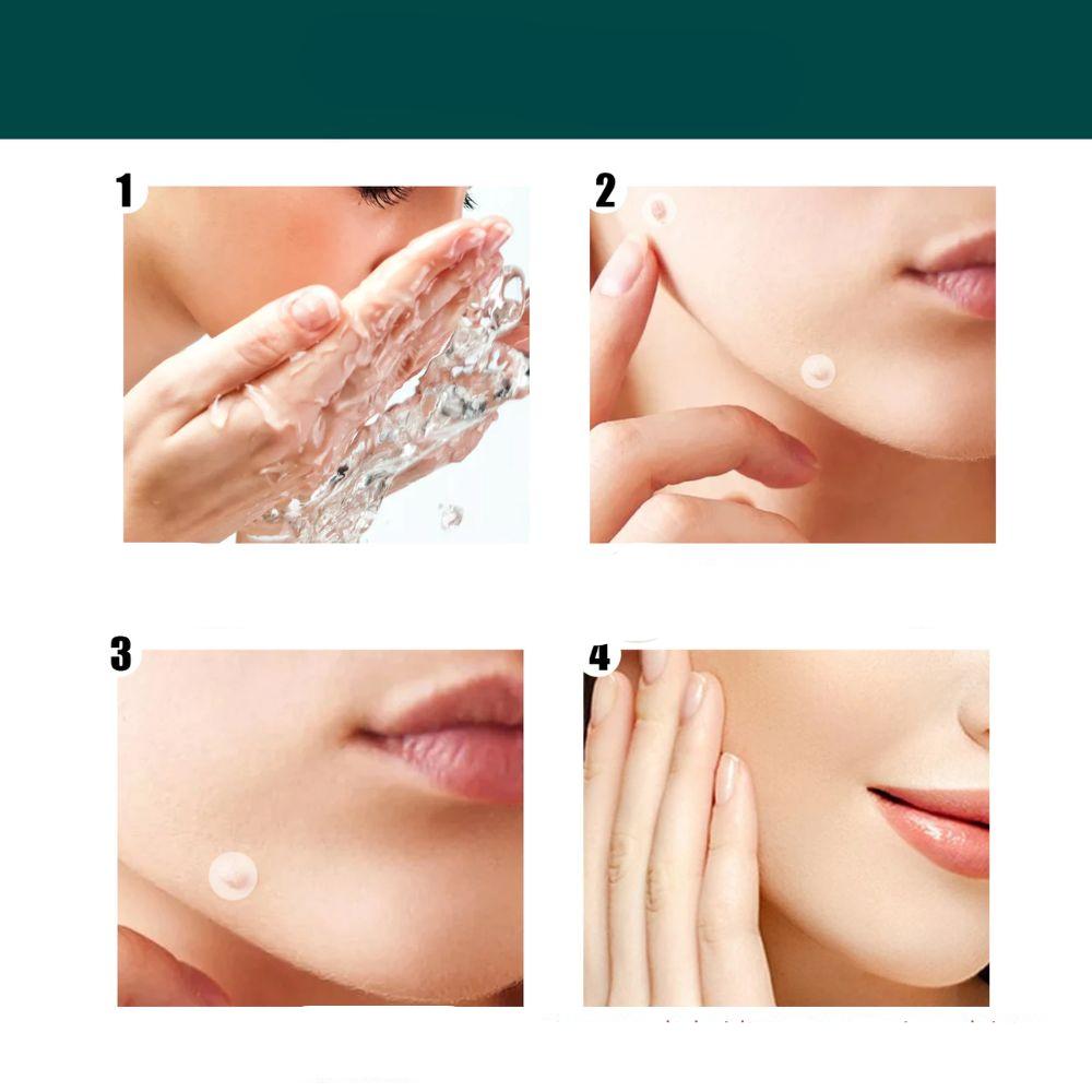 Kalsten | SkinClear - Plaster for the removal of spots and warts