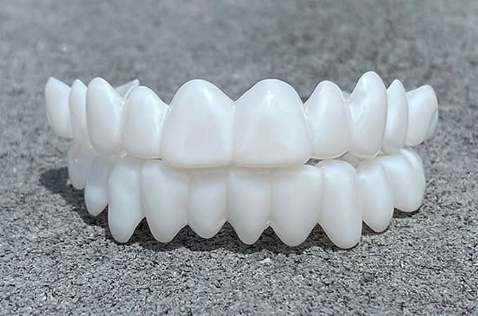 Kalsten | Customizable Dental Prosthesis with Dental Lenses