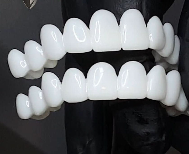 Kalsten | Customizable Dental Prosthesis with Dental Lenses