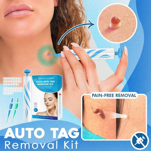 Kalsten | Quick Removal Kit