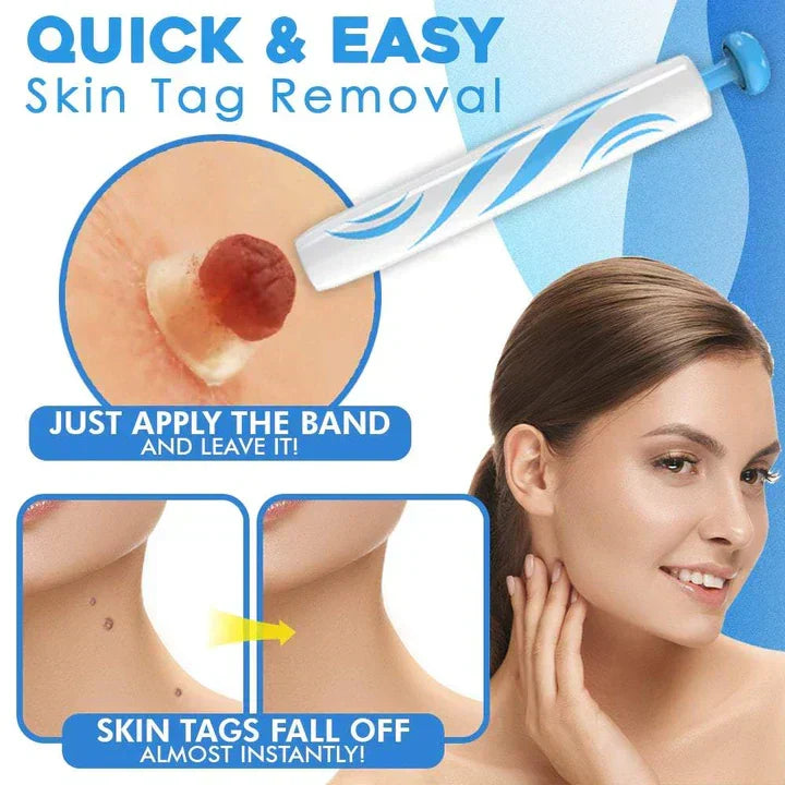 Kalsten | Quick Removal Kit