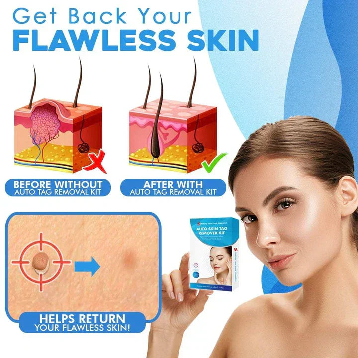 Kalsten | Quick Removal Kit