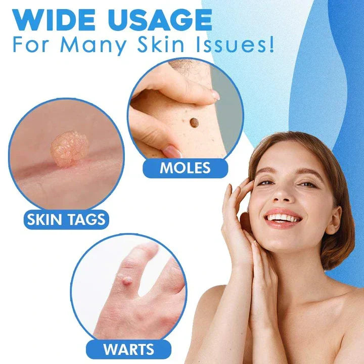 Kalsten | Quick Removal Kit