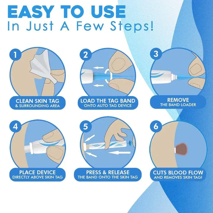 Kalsten | Quick Removal Kit