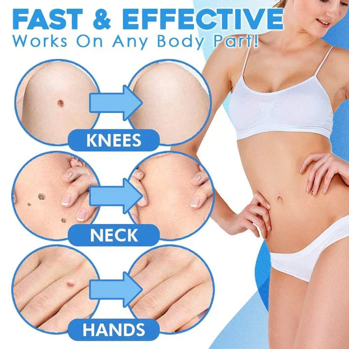 Kalsten | Quick Removal Kit
