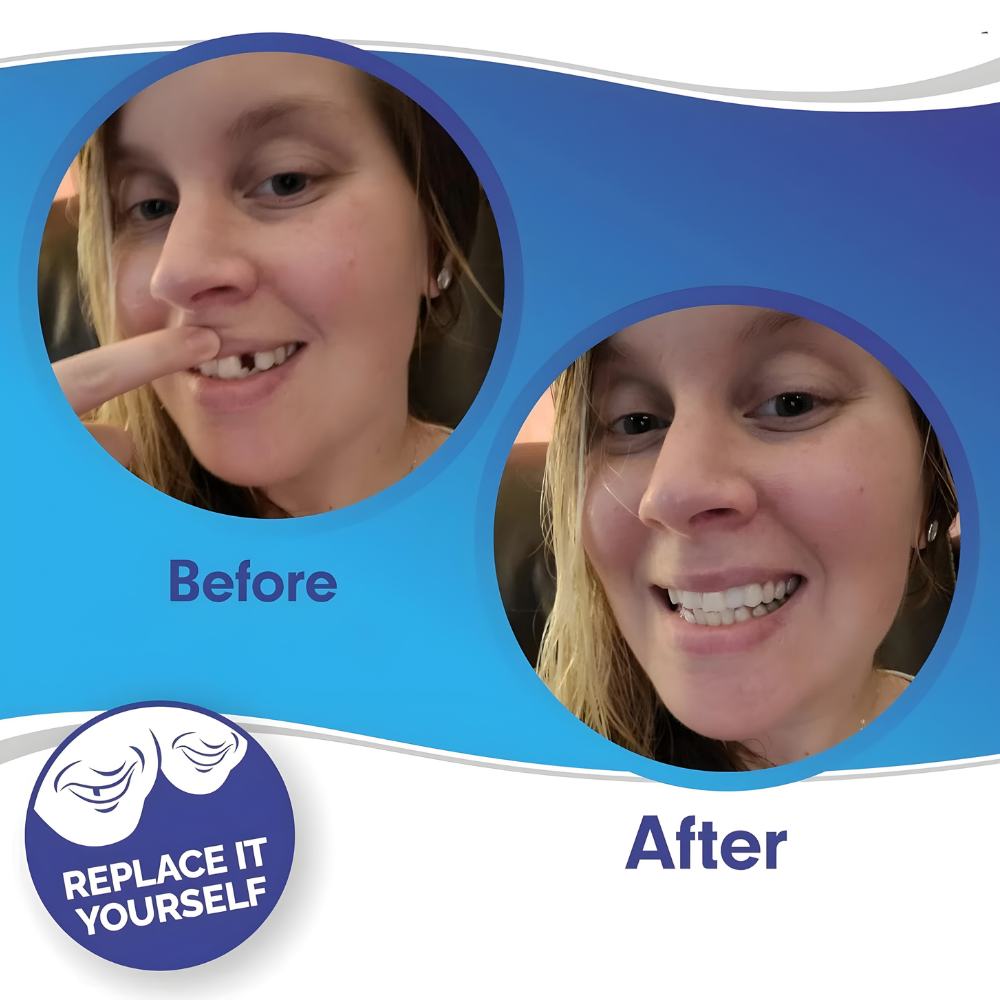 Kalsten | Removable Veneers Teeth Cover