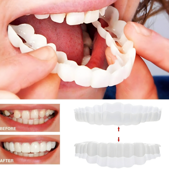 Kalsten | Removable Veneers Teeth Cover