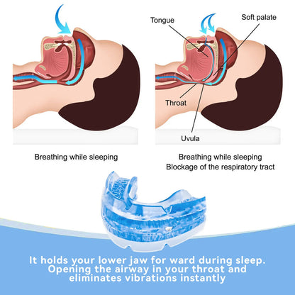 Skanto | Adjustable Anti-Snoring Mouthpiece Made of BPA-Free Material