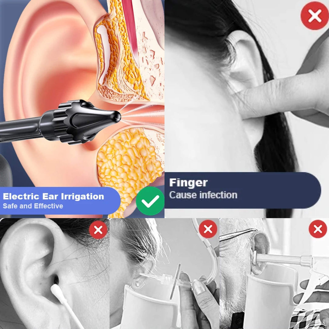Kalsten | Wush Pro Ear Cleaner – Effective Ear Cleaning Solution for Cleaner, Healthier Ears