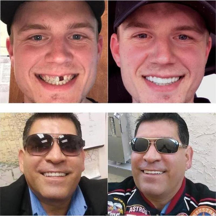 Kalsten | Snap-On Dentures