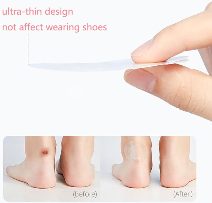 Kalsten | SootheStep – Transparent Gel Pads that instantly prevent blisters
