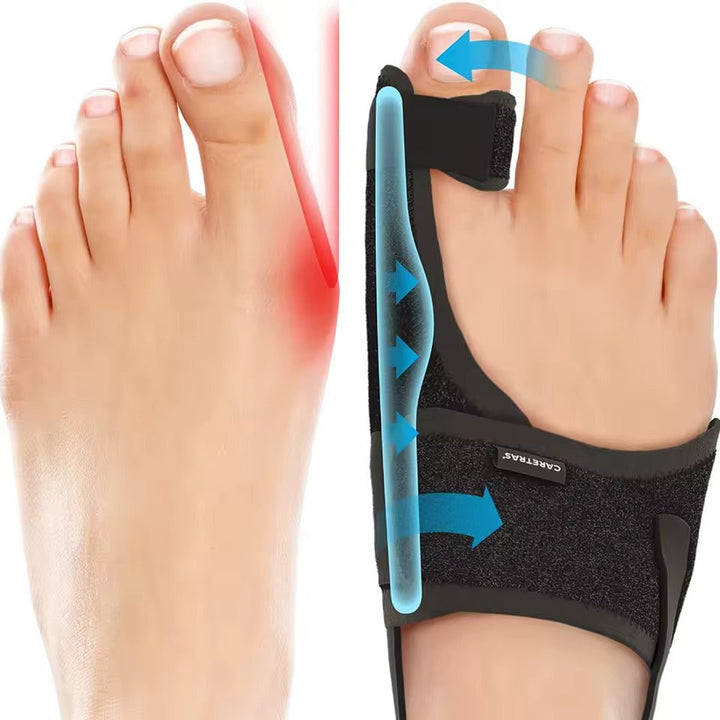 Kalsten | Night Splint Hallux Valgus - Ergonomic and Adjustable Comfort