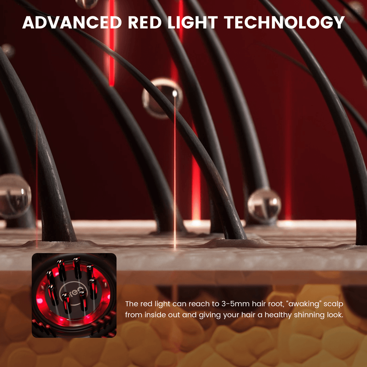 Skanto | Scalp Massage Brush with Red Light Therapy | Promotes Hair Growth & Relieves Scalp Tension for Healthier Hair